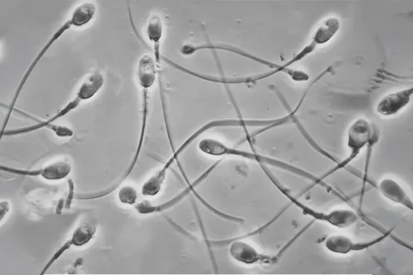 IMSI / PICSI — Advanced Sperm Selection