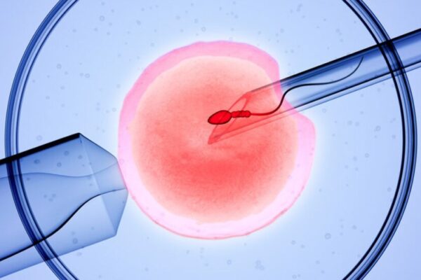 IVF Treatment