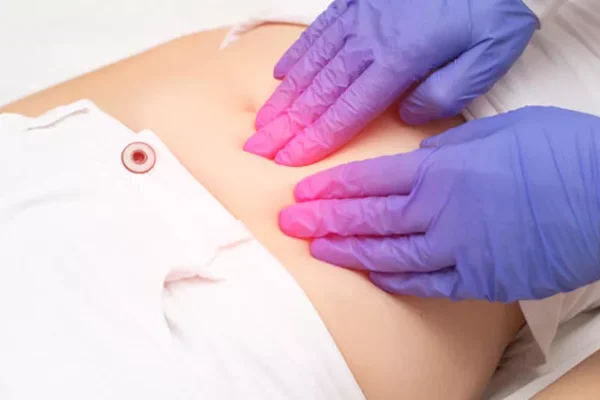 Private PCOS Specialist Treatment