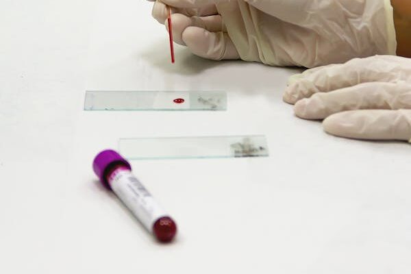 STD Screening